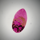 Hymenolepis diminuta