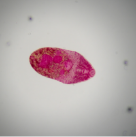 Hymenolepis diminuta