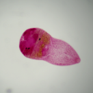 Hymenolepis diminuta