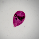 Hymenolepis diminuta