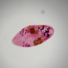 Hymenolepis diminuta