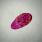 Hymenolepis diminuta