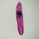 Hymenolepis diminuta