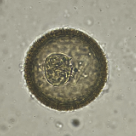 Hymenolepis diminuta