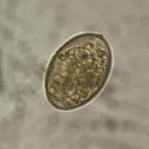 Hymenolepis diminuta