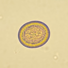 Hymenolepis diminuta