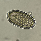 Hymenolepis diminuta