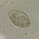 Hymenolepis diminuta