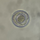 Hymenolepis diminuta