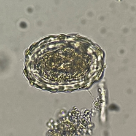 Hymenolepis diminuta