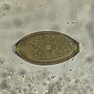 Hymenolepis diminuta